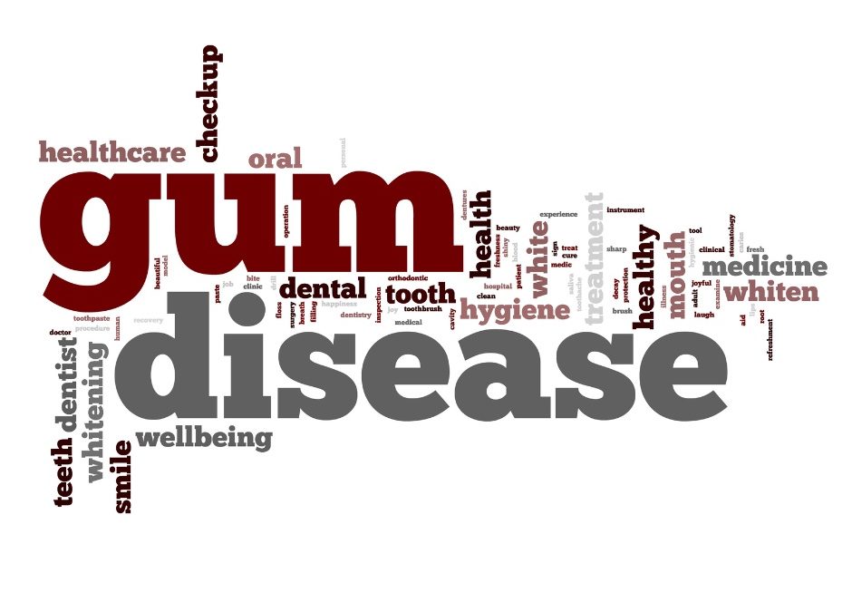 Gum Disease Awareness Month –  3 Surprising Facts About Gum Disease