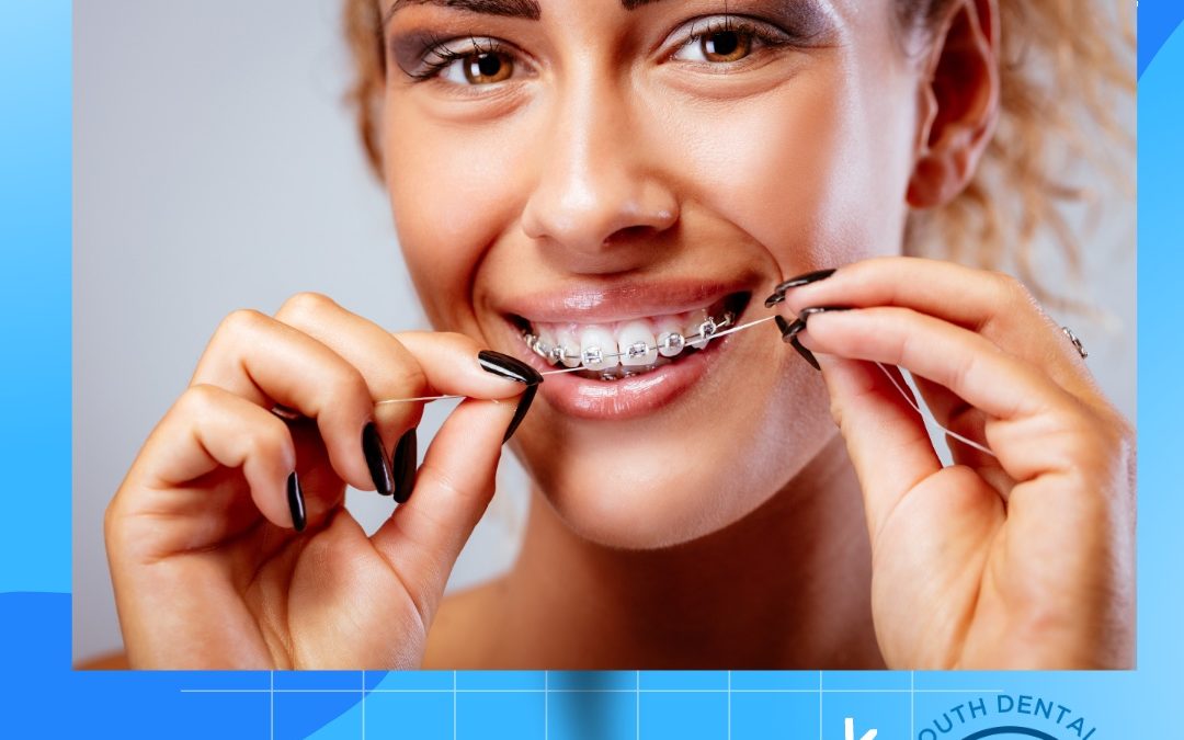 Image of a woman flossing with braces