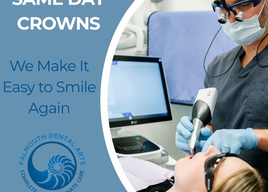 Smile in a Day: What to Know About Same Day Crowns